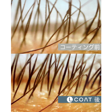 Lコート有無マクロ比較