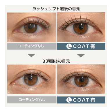 ラッシュリフト比較まとめ